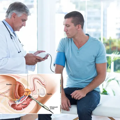 Benefits of Choosing Urology Surgery Center 



 for Your Penile Implant