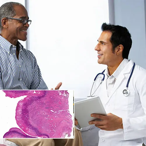 Navigating Insurance Coverage for Penile Implants