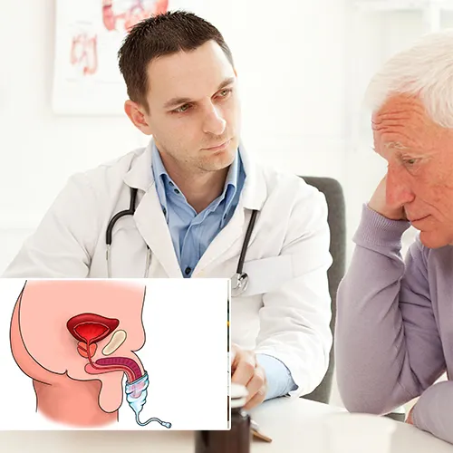 Welcome to  Urology Surgery Center 



Your Guide to Penile Implant Longevity and Performance