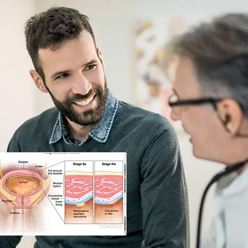 Steps to Administering Penile Injections